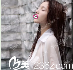 北京藝星整形美容醫(yī)院假體隆胸術(shù)前照 北京藝星整形美容醫(yī)院假體隆胸術(shù)前照