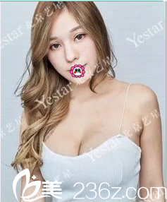 北京藝星假體隆胸術(shù)后28天<span style= 北京藝星假體隆胸術(shù)后28天<span style=