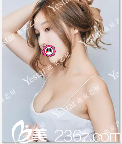 <!--<i data=20240703-sp></i>-->假體隆胸術(shù)后45天<span style= <!--<i data=20240703-sp></i>-->假體隆胸術(shù)后45天<span style=