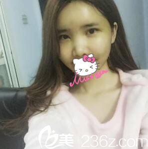 術(shù)后第五天