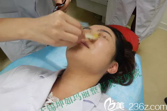 注射隆鼻術(shù)前的清潔和消毒 注射隆鼻術(shù)前的清潔和消毒