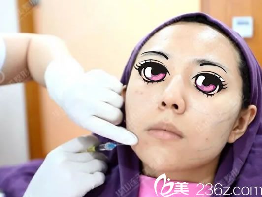 連天美注射玻尿酸填充過程