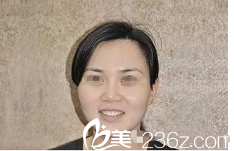 王者之心光子嫩膚的效果真的有那么好嗎?在常州博仕體驗(yàn)過后皮膚水嫩嫩