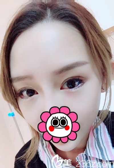 <!--<i data=20240703-sp></i>-->下眼瞼下至手術(shù)當(dāng)天 <!--<i data=20240703-sp></i>-->下眼瞼下至手術(shù)當(dāng)天