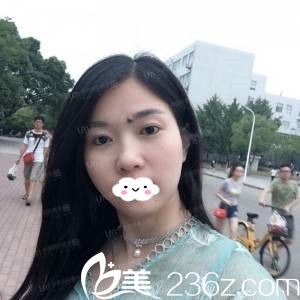 手術(shù)后的我 手術(shù)后的我