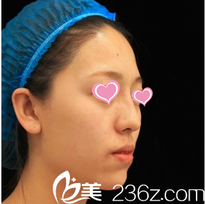 韓國(guó)Stanley皮膚科李恩碩案例