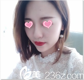 李恩碩注射7天效果