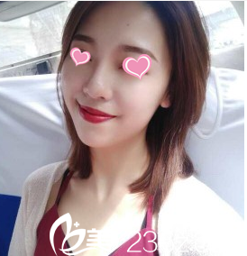 韓國(guó)Stanley皮膚科治療后17天樣子