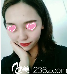 沒想到在韓國Stanley皮膚科注射32天效果肌膚這般水嫩