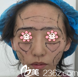 朱紅振醫(yī)生給我面診