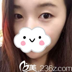 單眼皮的我 單眼皮的我