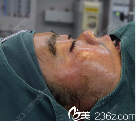 李明主任肋軟骨綜合隆鼻術前麻醉 李明主任肋軟骨綜合隆鼻術前麻醉