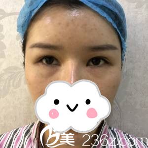 手術(shù)前的我 手術(shù)前的我