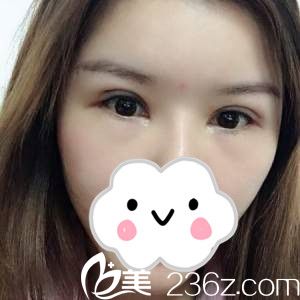 術(shù)后一周 術(shù)后一周