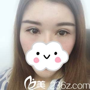 手術(shù)第18天 手術(shù)第18天