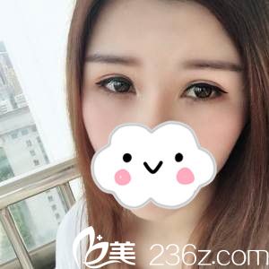 術(shù)后26天 術(shù)后26天
