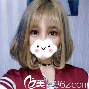 手術(shù)后第24天 手術(shù)后第24天