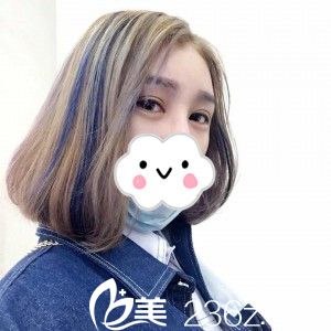 雙眼皮怎么樣？8mm和6mm哪個好？看我割的雙眼皮全過程記錄