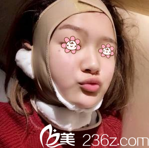 才俊明醫(yī)生給我術(shù)后第三天