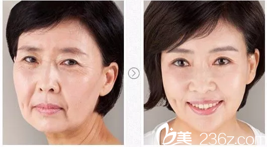 東莞南城瑞芙整形醫(yī)院路世敏<span style=