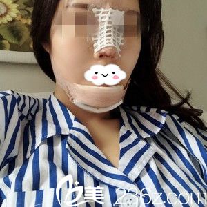 術(shù)后天 術(shù)后天