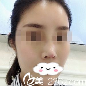 術(shù)后一周 術(shù)后一周