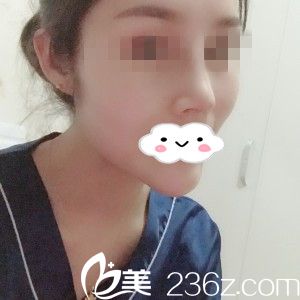 術(shù)后半個月 術(shù)后半個月