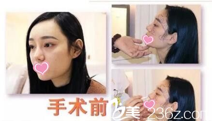 陳院長術(shù)前面診設計畫線 陳院長術(shù)前面診設計畫線