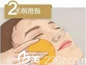 埋線提升術(shù)第二部