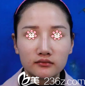 我去新疆黎美整形醫(yī)院面診 我去新疆黎美整形醫(yī)院面診