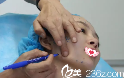 康寶峰醫(yī)生為我注射前畫線