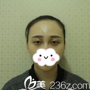 手術(shù)前的我 手術(shù)前的我