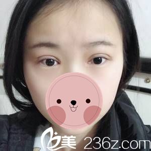 術(shù)后六天效果 術(shù)后六天效果