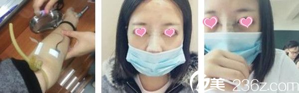 贛州韓美整形醫(yī)院隆鼻手術(shù)案例 贛州韓美整形醫(yī)院隆鼻手術(shù)案例