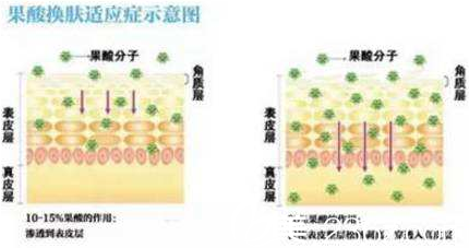 果酸嫩膚的方法