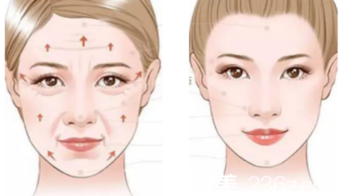 于曉春面部微雕示意圖效果展示