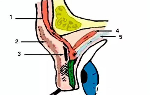 上瞼下垂矯正CFS手術(shù) 上瞼下垂矯正CFS手術(shù)