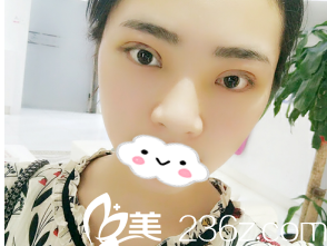 術(shù)后第三天 術(shù)后第三天