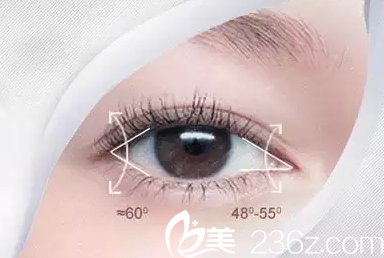 長(zhǎng)春開(kāi)眼角手術(shù)價(jià)格是多少？長(zhǎng)春秀爾開(kāi)眼角手術(shù)7800元起助你擁有美眼