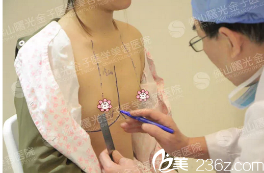 佛山曙光金子何宜新院長(zhǎng)隆胸術(shù)前劃線設(shè)計(jì)中 佛山曙光金子何宜新院長(zhǎng)隆胸術(shù)前劃線設(shè)計(jì)中