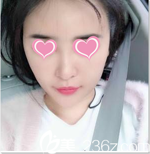 北京知音生長(zhǎng)因子取出 北京知音生長(zhǎng)因子取出