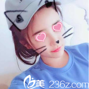 生長(zhǎng)因子取出術(shù)后64天 生長(zhǎng)因子取出術(shù)后64天