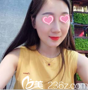 北京知音生長因子取出怎么樣？來看北京知音真人案例第85天效果