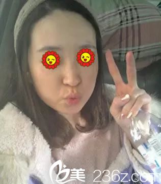 在臺州維多利亞做隆鼻手術(shù)前 在臺州維多利亞做隆鼻手術(shù)前