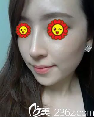 臺州維多利亞常文彥隆鼻<span style= 臺州維多利亞常文彥隆鼻<span style=