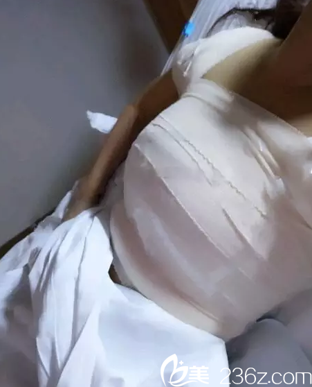 在南寧東方做假體隆胸手術(shù)當(dāng)天 在南寧東方做假體隆胸手術(shù)當(dāng)天