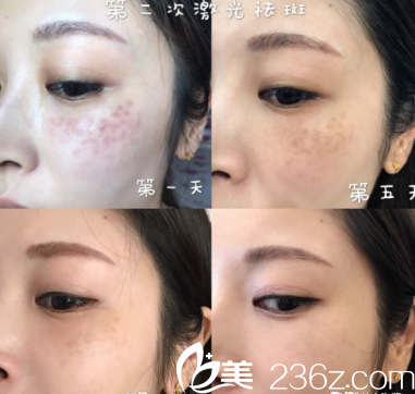 看著我的臉一點點的變白我真的很開心