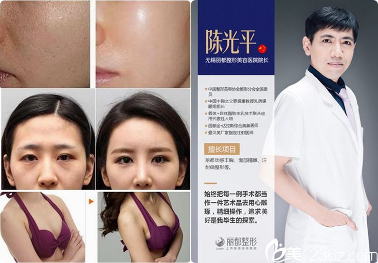 陳光平醫(yī)生隆胸案例