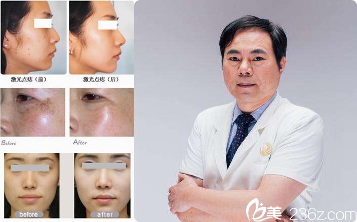 趙堅鋼院長整形案例