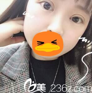 眼綜合手術(shù)術(shù)后10天照